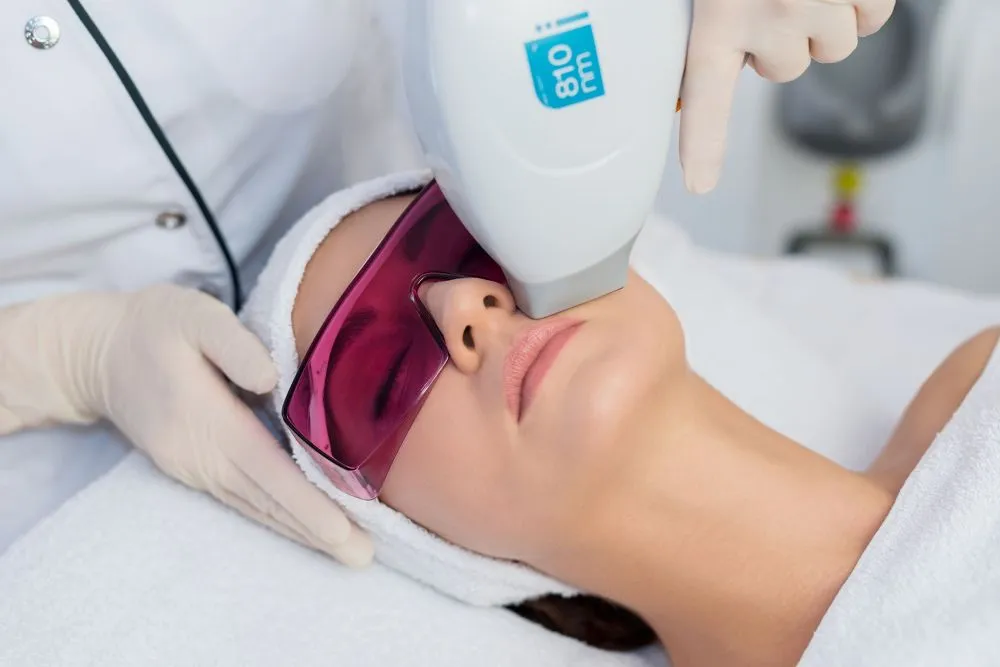 Laser Haarentfernung Oldenburg – Haarentfernung im Gesicht und behandelbare Körperareale